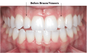 Screen Shot 2015-10-11 at 7.46.27 AM