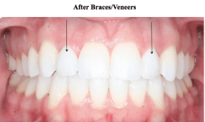 Screen Shot 2015-10-11 at 7.46.40 AM