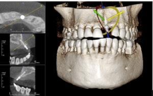 Screen Shot 2015-10-25 at 10.15.10 PM